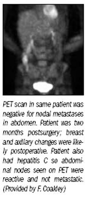 Learn what you need to know about oncology imaging