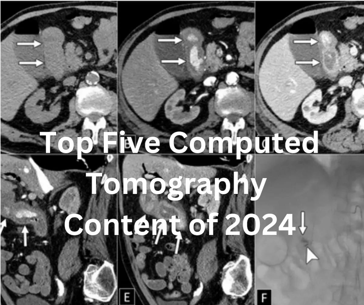 Top Five Computed Tomography Content of 2024
