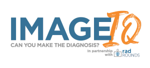 Image IQ Quiz: 52-Year-Old Patient with Upper Abdominal Pain, Early Satiety and Nausea