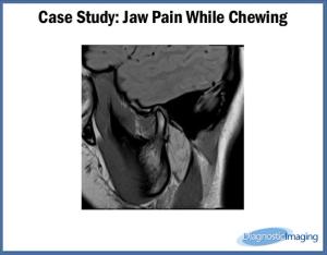 Jaw Pain While Chewing