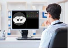 FDA Clears AI-Powered Software for Assessment of Incidental Lung Nodules on CT