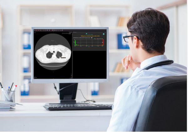 FDA Clears AI-Powered Software for Assessment of Incidental Lung Nodules on CT