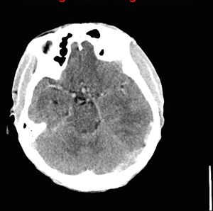 Image IQ: History of Cyanotic Congenital Heart Disease