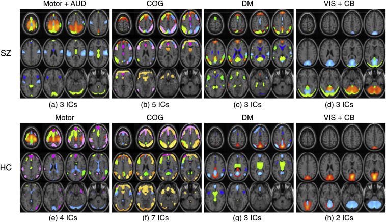 New fMRI Analysis Could Improve Schizophrenia Treatment | Diagnostic ...