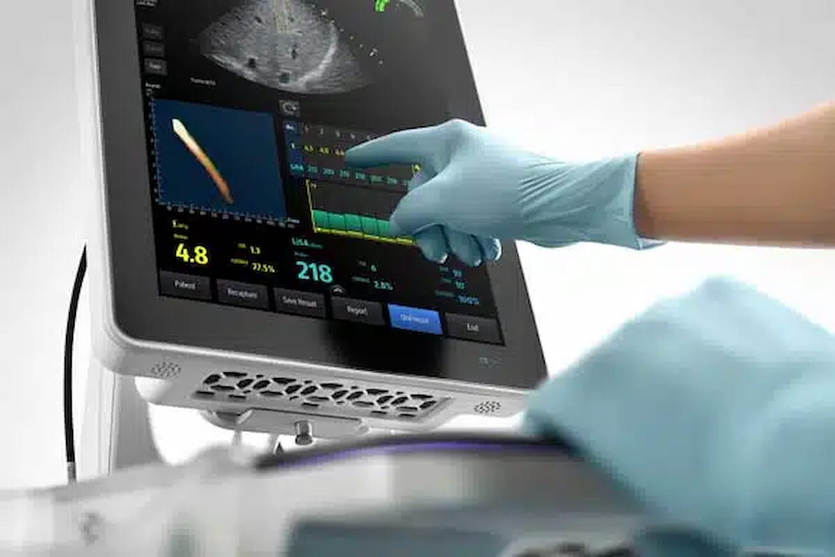 New System Combines Diagnostic Ultrasound and Transient Elastography