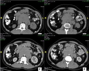 Image IQ: 32-year-old Male with Abdominal Discomfort