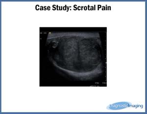 Scrotal Pain