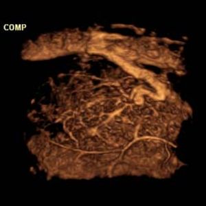 Emergence of elastography gives renewed impetus and vigor to ultrasound market