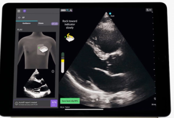 GE HealthCare Adds AI Guidance to Cardiac Ultrasound Assessments with Vscan Air SL 