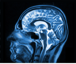FDA Approves New MRI Contrast Agent Gadopiclenol