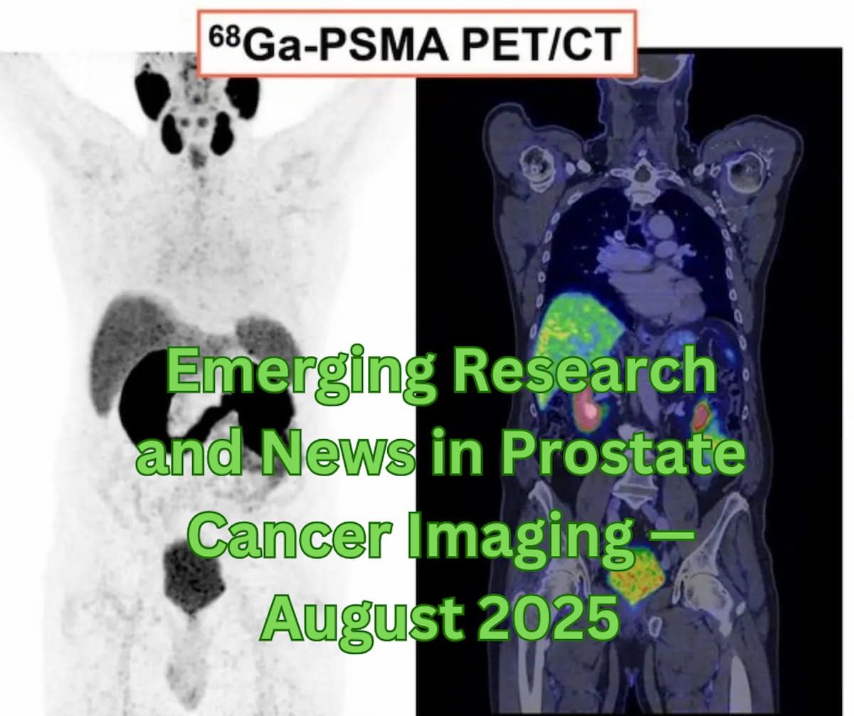 Emerging Research and News in Prostate Cancer Imaging — August 2025