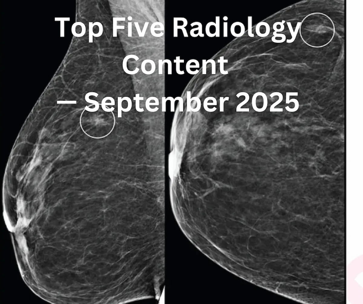 Top Five Radiology Content — September 2025