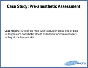 Pre-anesthetic Assessment
