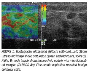 Real-time elasticity findingsimprove breast specificity