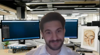 COVID-19 and CT Scans: The Global Backlog, Rebound, and Implications