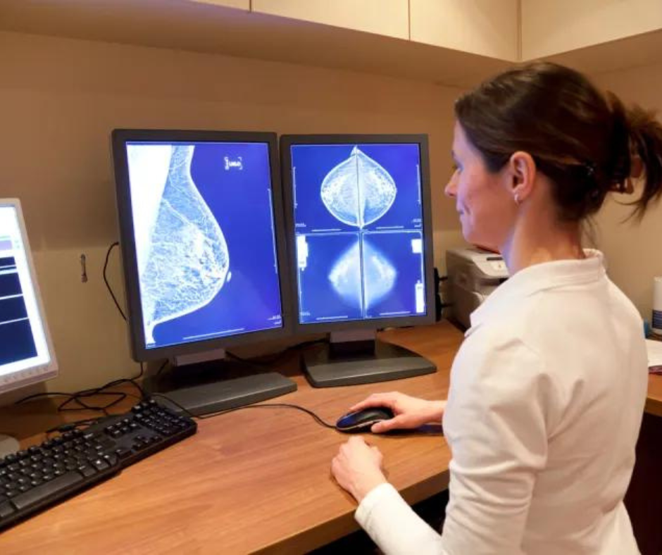 FDA Issues Final Rule on National Breast Density Notification for Mammography Reports