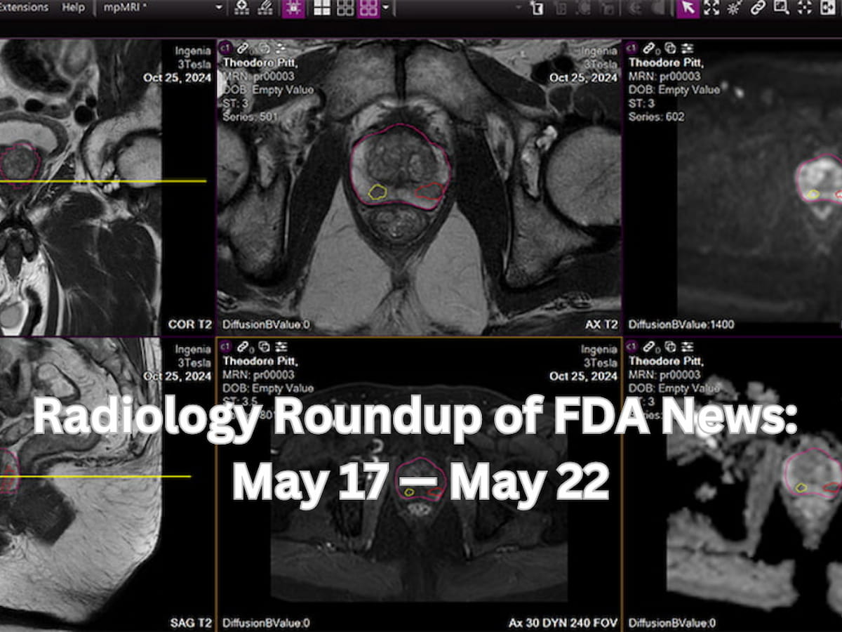 Radiology Roundup of FDA News: May 17 — May 22