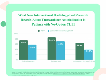 Interventional Radiology-Led Study Shows Significant Limb Salvage Benefits with Transcatheter Arterialization