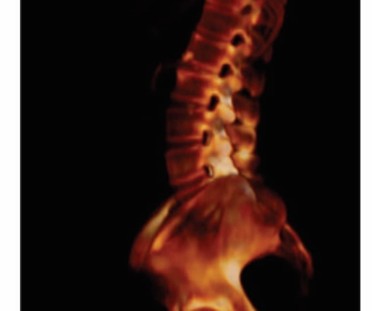 FDA Clears Image Processing Software with Emphasis on Nuclear Medicine Imaging Workflow