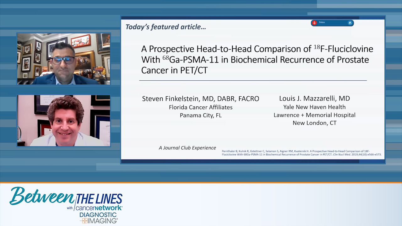 prostate cancer doctors