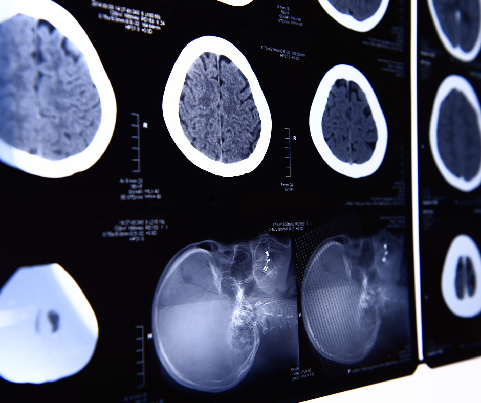 GE Healthcare Announces Moves to Bolster Supply of Iodinated Contrast Media for CT and X-Ray Imaging