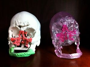 Medical Imaging and 3-D Hollywood Animation Combine to Aid in Face Transplants