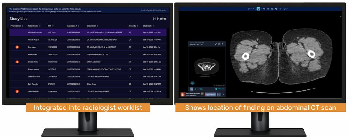 CT Triage Software Garners NTAP Reimbursement from CMS for Inpatient Medicare Beneficiaries