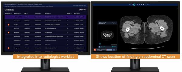 CT Triage Software Garners NTAP Reimbursement from CMS for Inpatient Medicare Beneficiaries