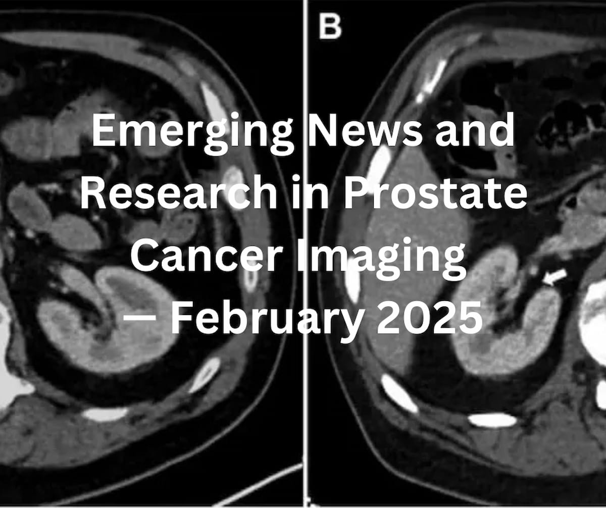Emerging Research and News in Prostate Cancer Imaging — February 2025