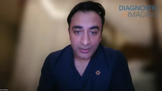 Prospective Study Shows Capability of CXR AI to Detect Early-Stage Lung Cancer in Young Patients and Never Smokers