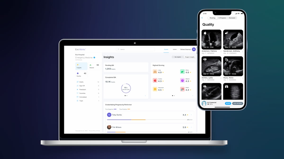 Exo Launches Point-Of-Care Ultrasound Package Exo Works Connect 