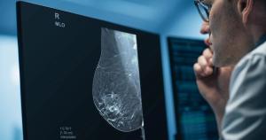 Deep Learning Software for 3D Mammography Reconstruction Gets FDA Premarket Authorization