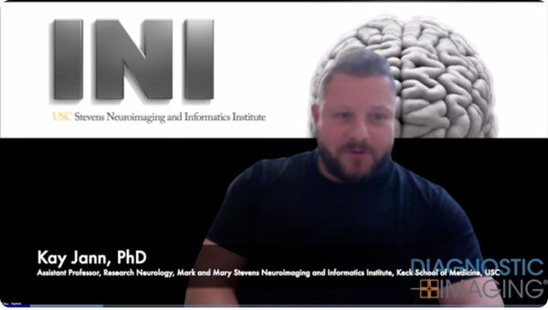 Can Brain MRI Help Predict Spinal Cord Stimulation Response for Treating Urinary Incontinence in Stroke Survivors?