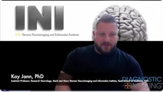 Can Brain MRI Help Predict Spinal Cord Stimulation Response for Treating Urinary Incontinence in Stroke Survivors?
