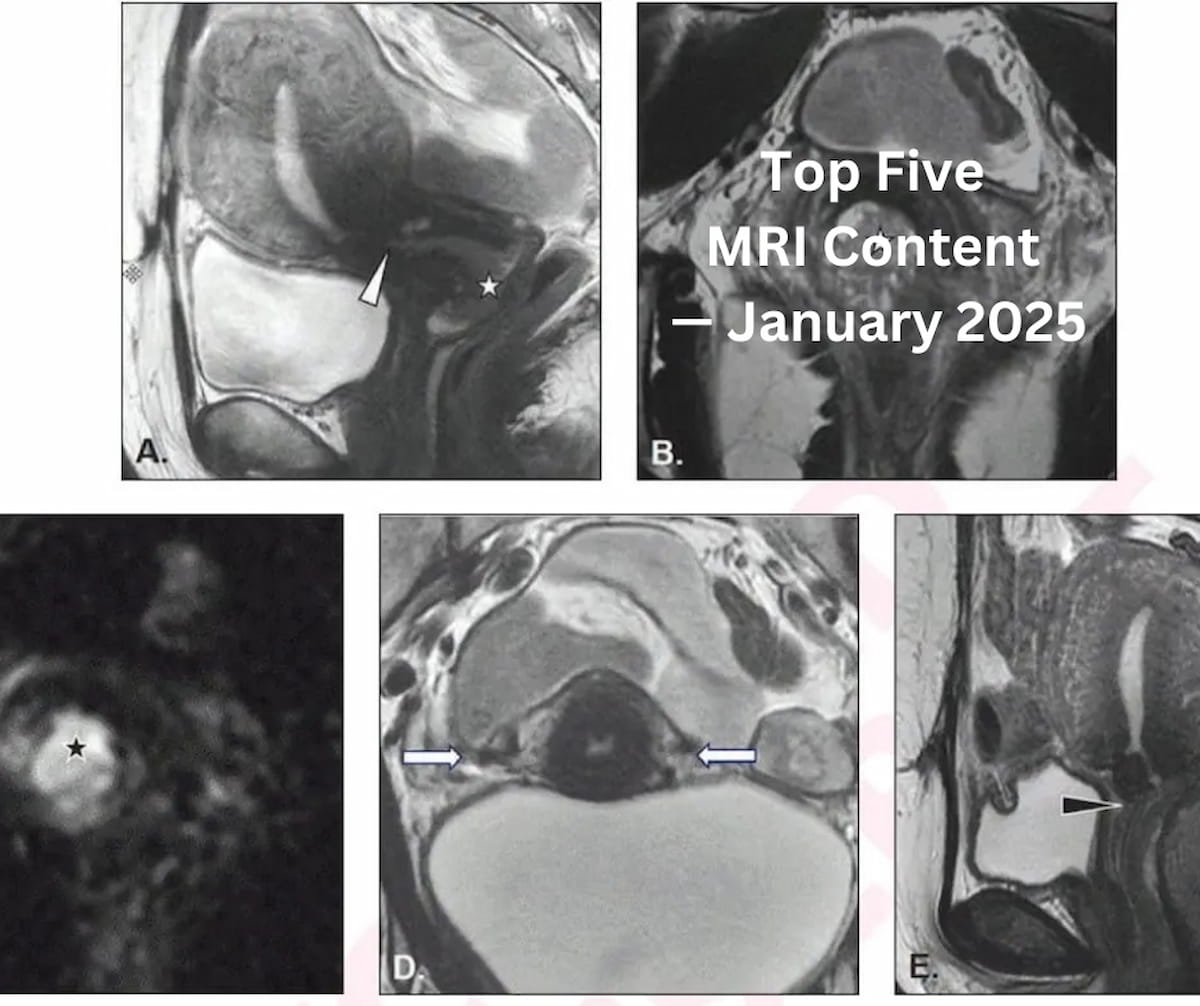 Top Five MRI Content — January 2025
