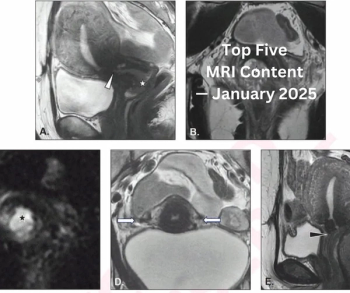Top Five MRI Content — January 2025