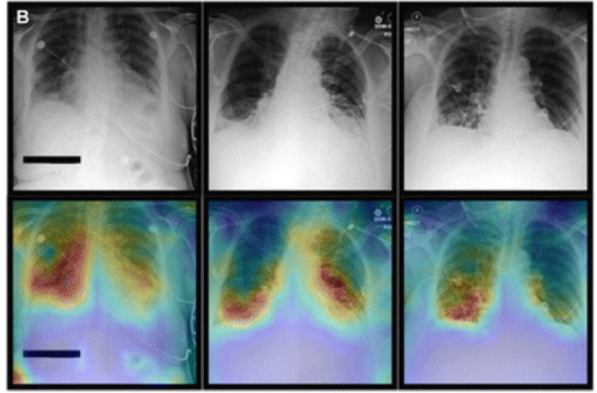 Transformer-Based Multimodal AI Model Improves Diagnosis of Over 20 Conditions with Chest X-Rays