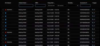 FDA Clears AI-Powered Triage Platform for Digital Breast Tomosynthesis