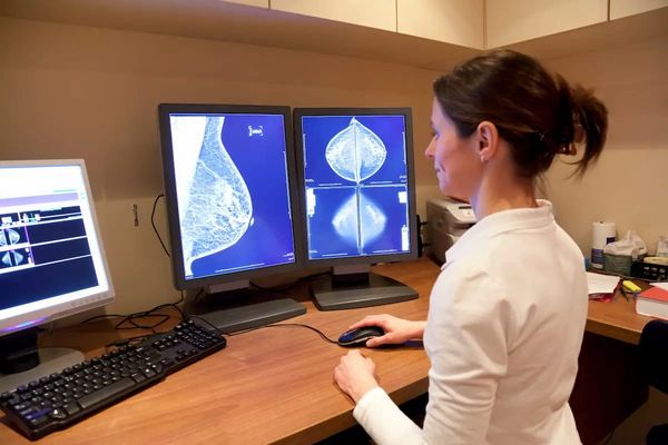 Large Mammography Study Suggests Adjunctive AI May Have an Impact in Reducing Interval Breast Cancer Rates