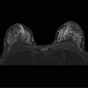 MR vendors look for patient-focused route to success