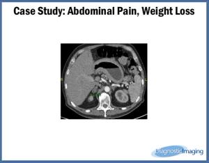 Abdominal Pain, Weight Loss