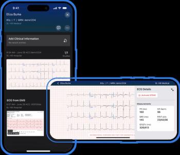 Viz.ai Launches ECG Platform to Streamline Workflow for Patients with Acute Coronary Syndrome