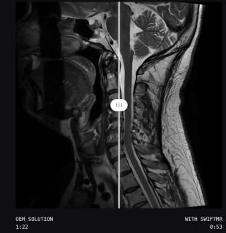 AI-Powered MRI Software Gets Expanded FDA Clearance for Use with Deep Learning Reconstruction Modalities