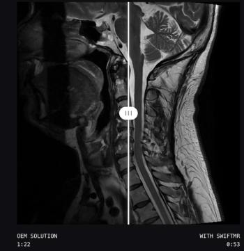 AI-Powered MRI Software Gets Expanded FDA Clearance for Use with Deep Learning Reconstruction Modalities
