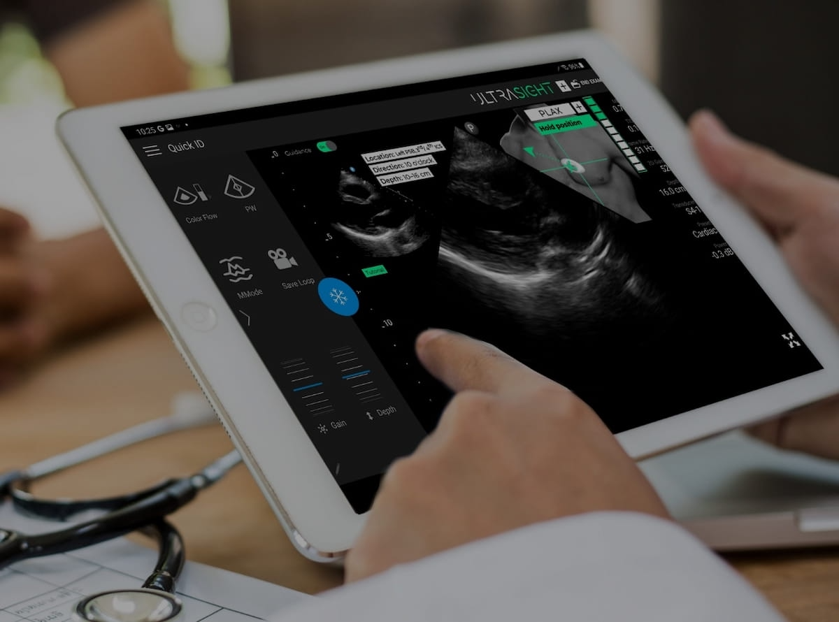 UltraSight’s AI-Powered Cardiac Ultrasound Guidance Gets FDA Nod
