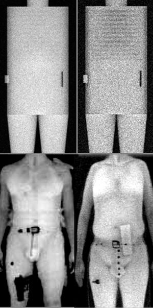 Phantom study suggests airport x-ray body scans could miss bombs