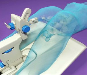 Pseudoangiomatous Stromal Hyperplasia