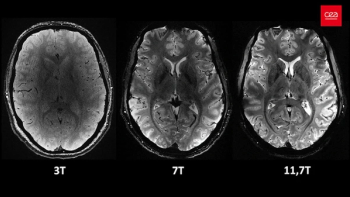 Essential Keys to MRI Safety in the Age of Advanced Diagnostics