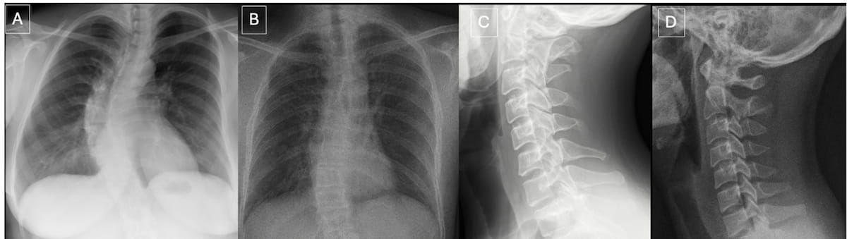 Can Radiologists Identify Fake Radiographs Created with AI?