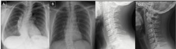 Can Radiologists Identify Fake Radiographs Created with AI?